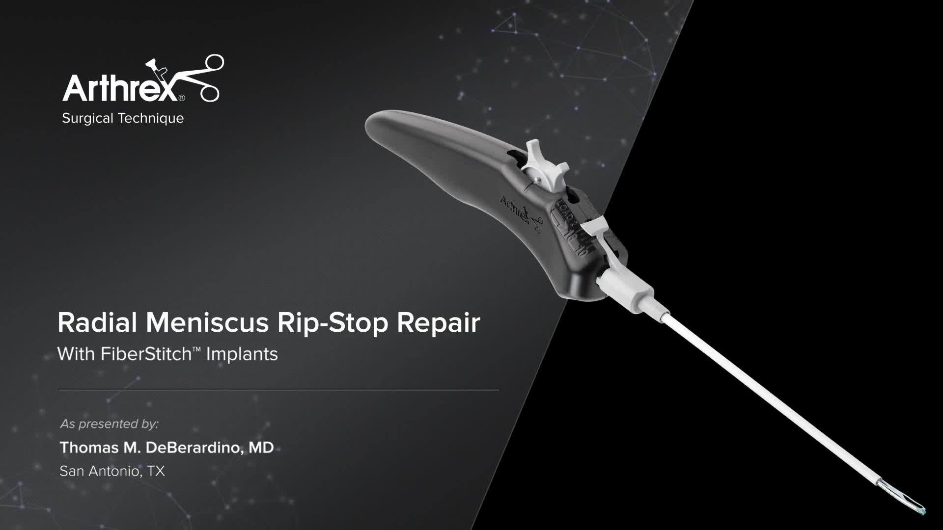 Arthrex - Radial Meniscus Rip-Stop Repair With FiberStitch™ Implants