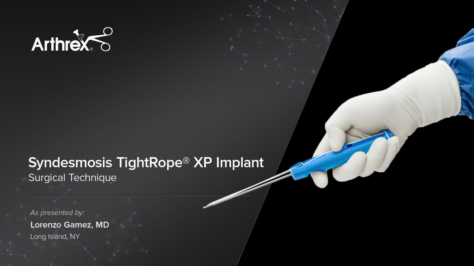 Arthrex - Syndesmosis TightRope® XP Implant