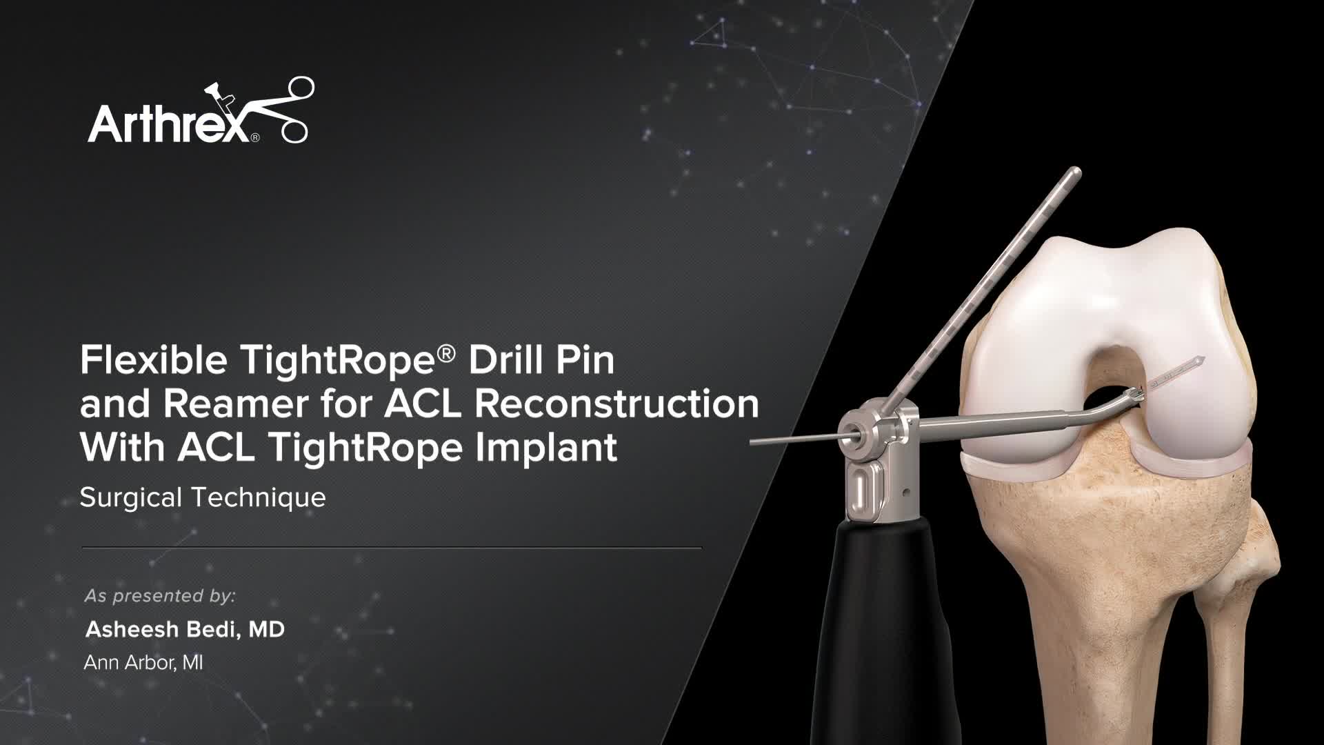 Arthrex - Flexible TightRope® Drill Pin and Reamer for ACL