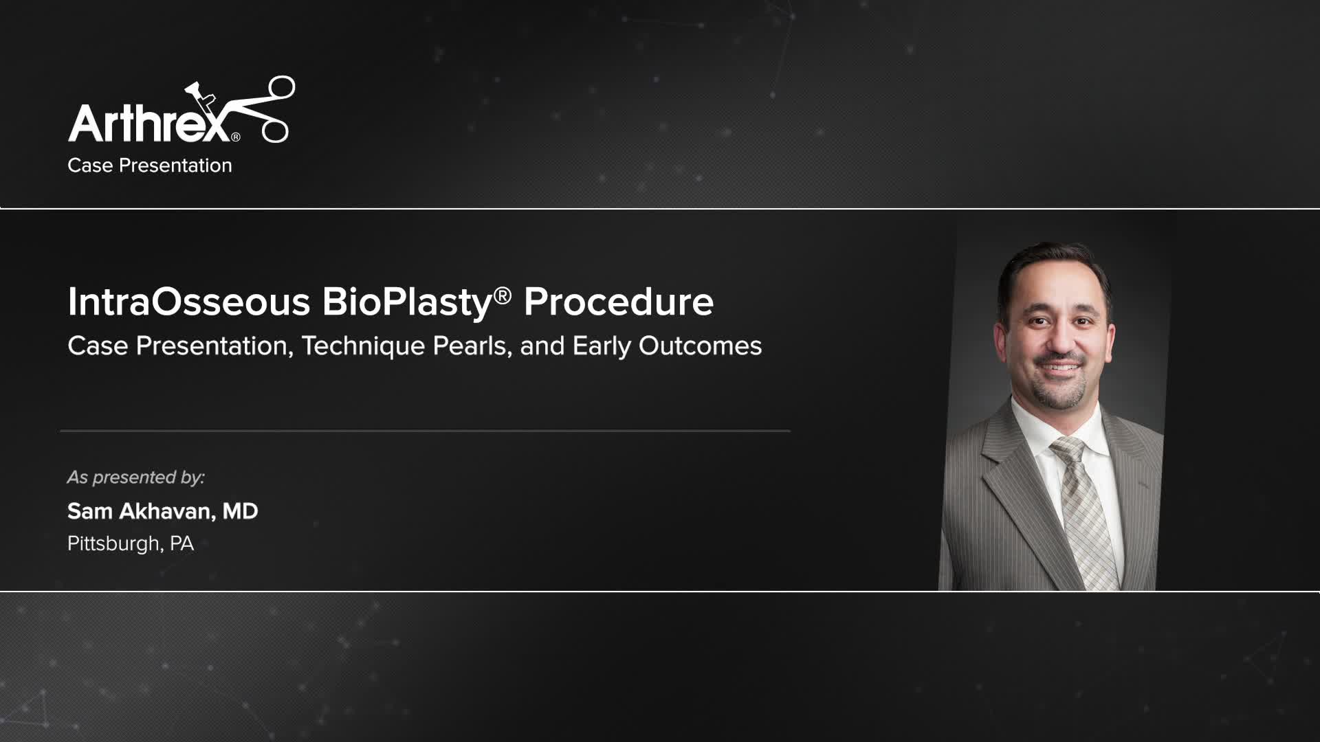 Arthrex - IntraOsseous BioPlasty® Procedure: Case Presentation ...