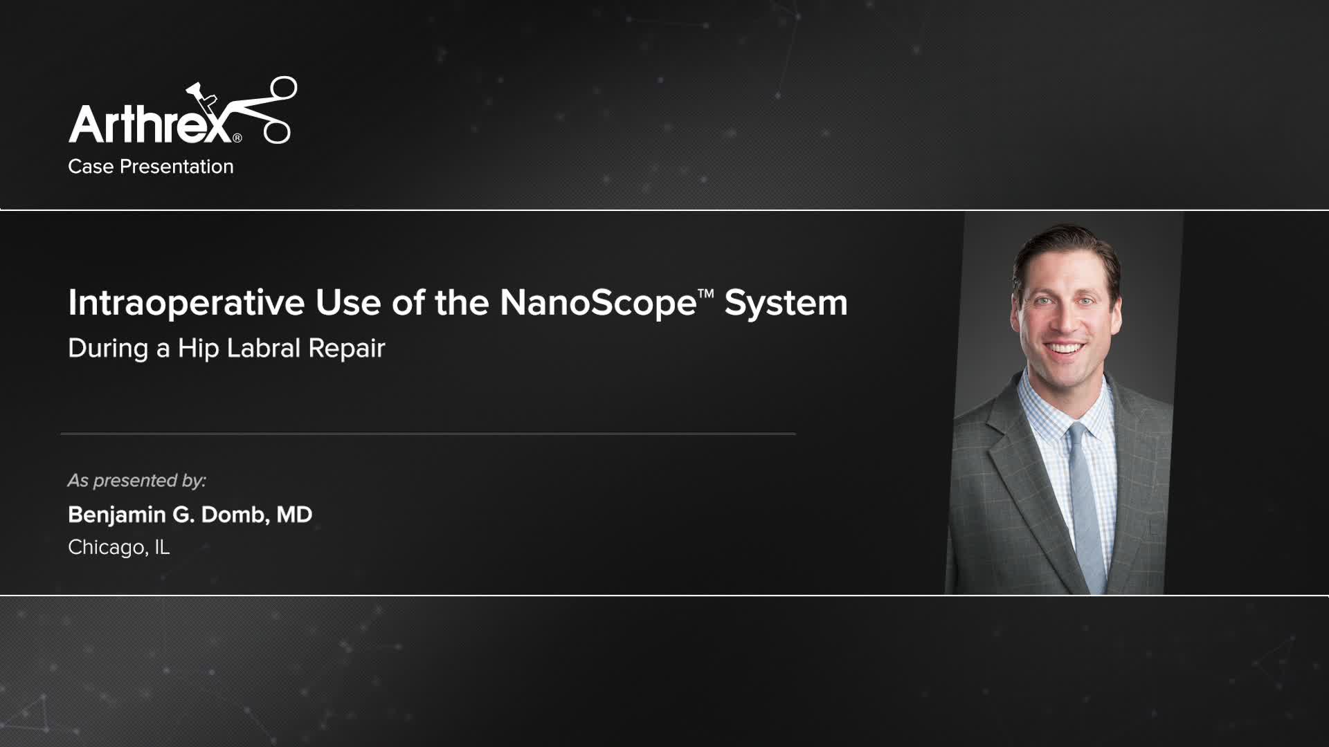 Arthrex Intraoperative Use Of The NanoScope System During A Hip