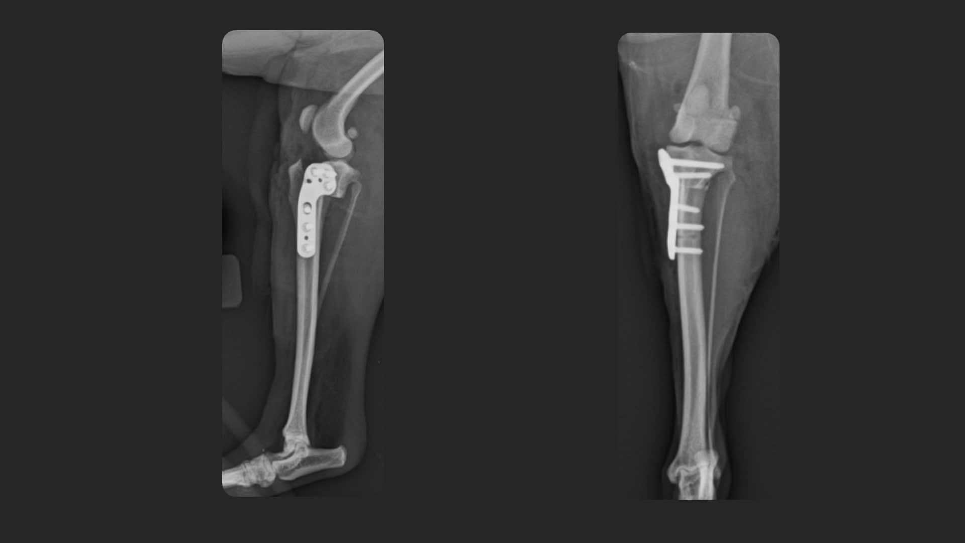 Arthrex - TPLO InternalBrace™ Ligament Augmentation Patient Evaluation ...