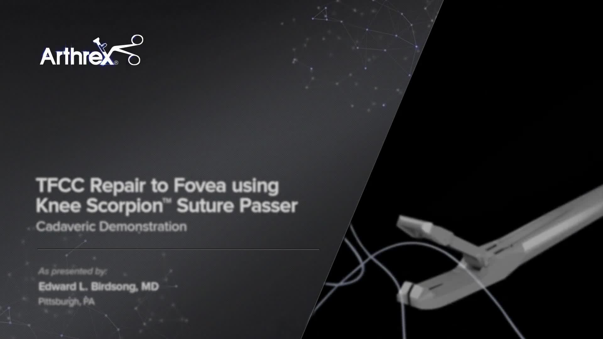 Arthrex - TFCC Repair to Fovea Using Knee Scorpion™ Suture