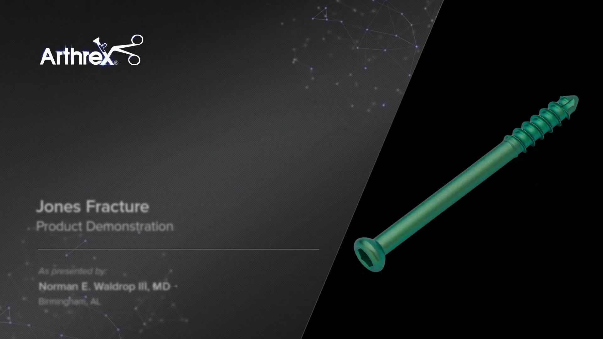 Arthrex - Jones Fracture