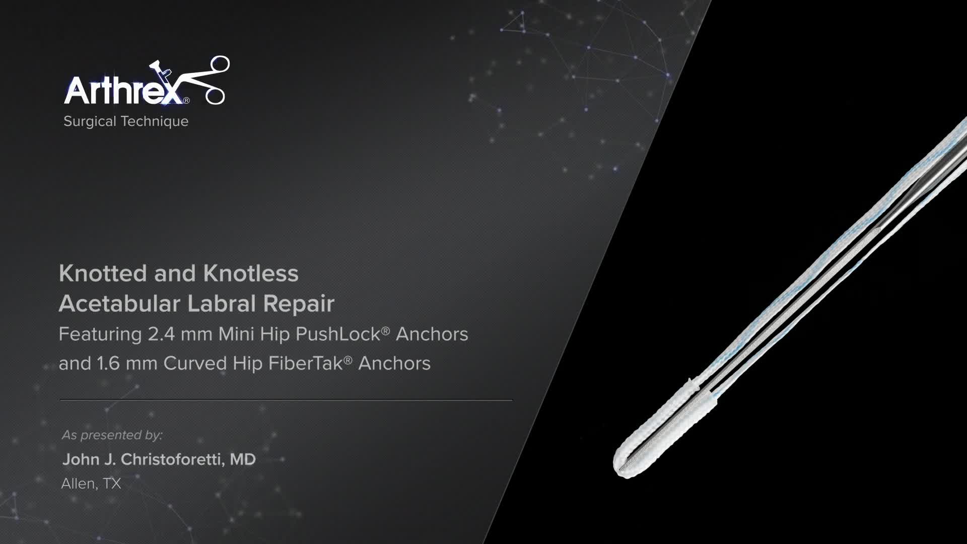 Arthrex - Knotted and Knotless Acetabular Labral Repair
