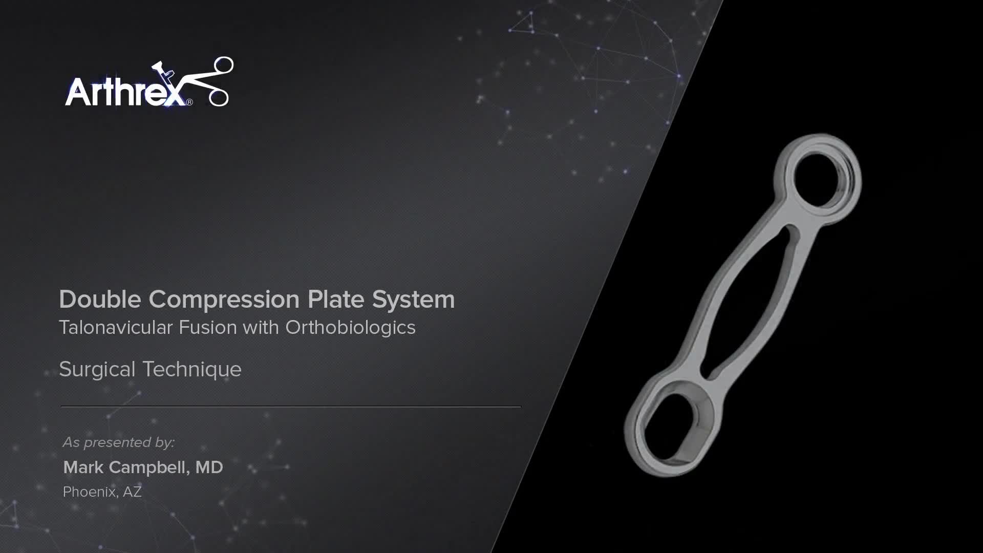 Arthrex - Double Compression Plate System - Talonavicular
