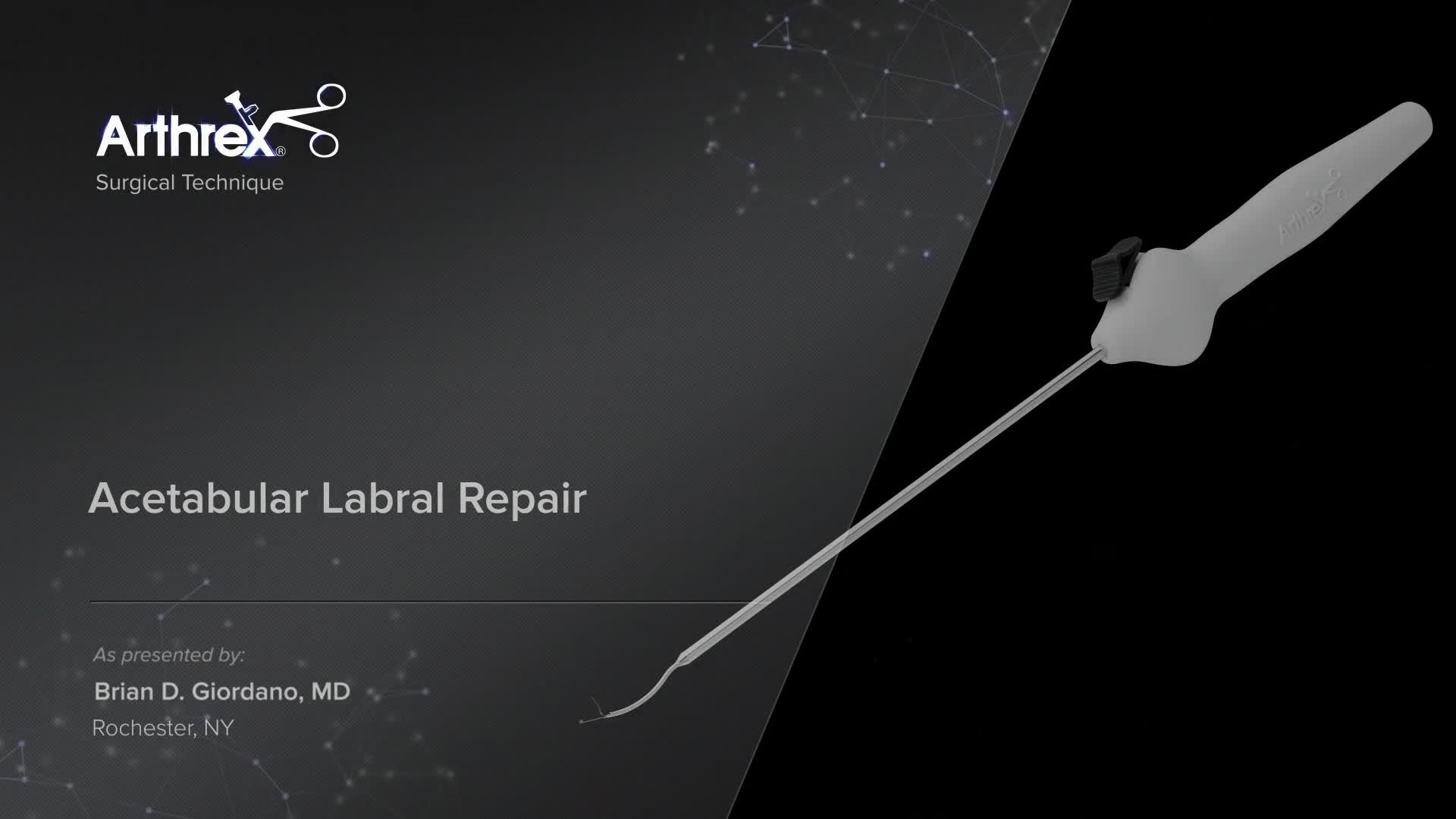 骨盤骨折　Surgical technique 下肢の骨折手術① 骨盤・大腿骨［Web動画付］ (新OS NEXUS No.4