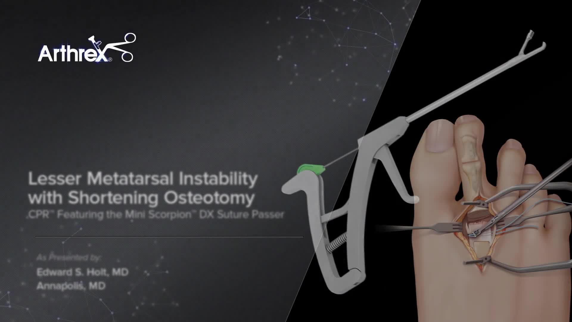 m3電子書籍 | ゼロからはじめる！Knee Osteotomy アップデート