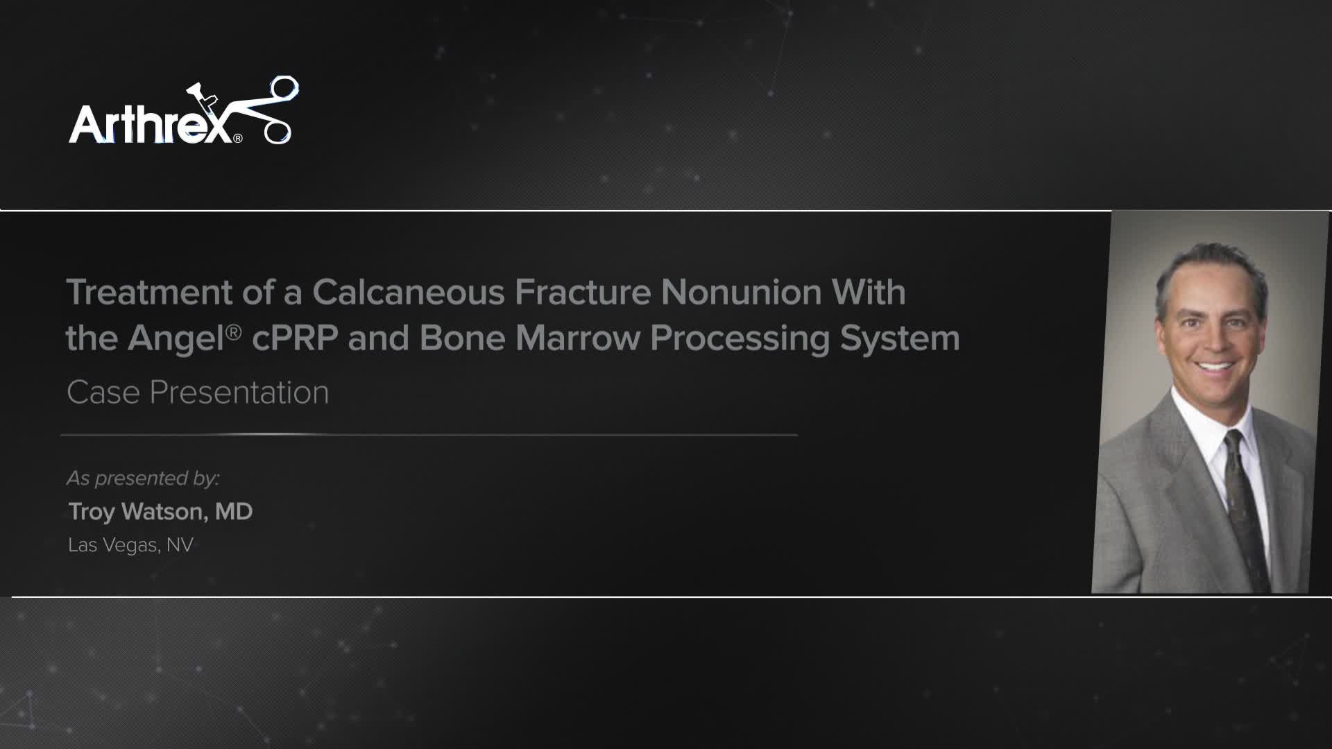 肉腫化学療法マスタークラス = Chemotherapy for Bone a… 肉腫化学療法マスタークラス = Chemotherapy for Bone a… 肉腫