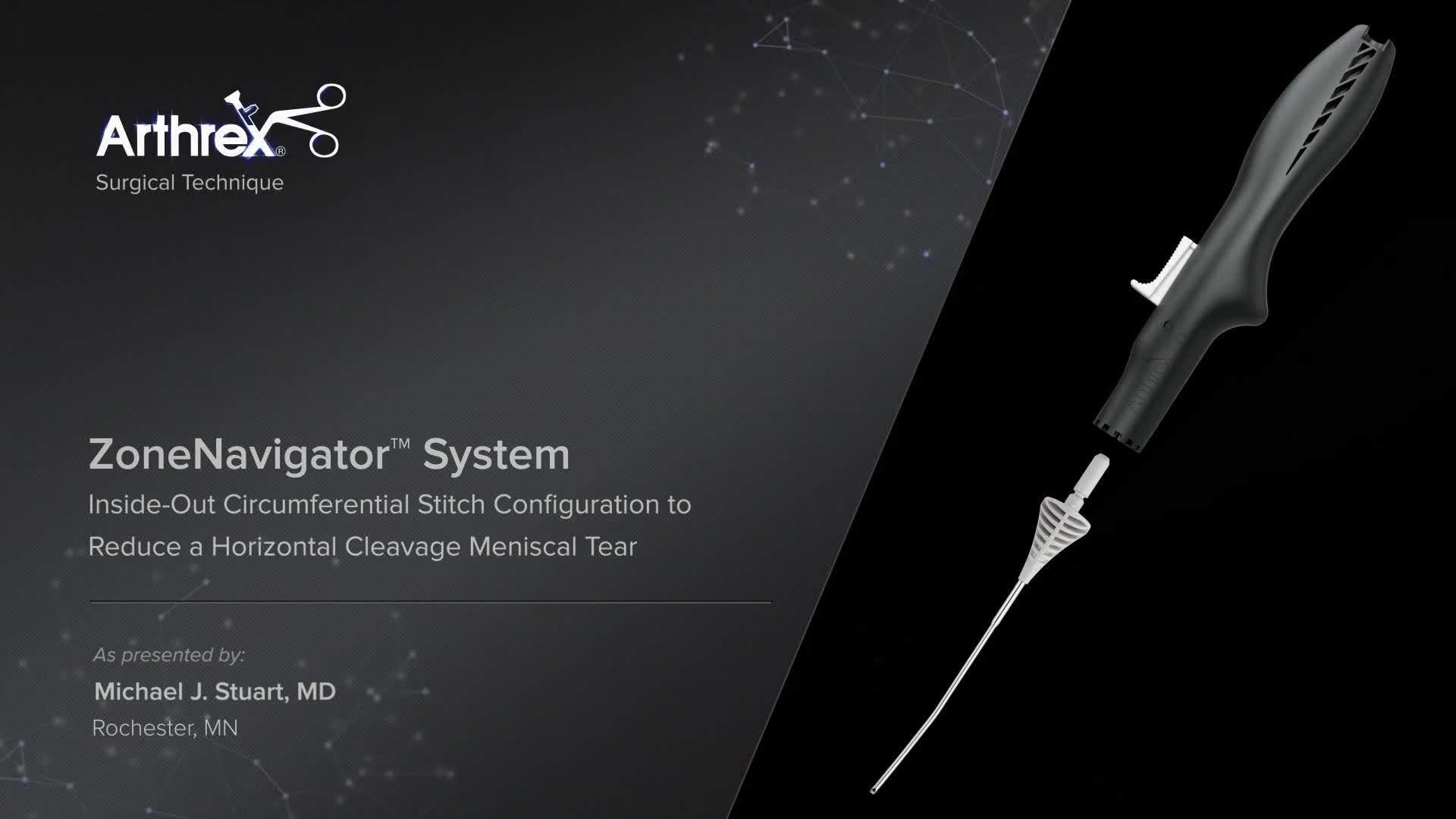 Arthrex - ZoneNavigator™ System Inside-Out Circumferential