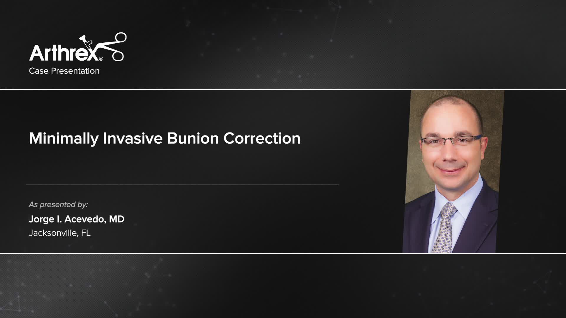 arthrex-minimally-invasive-bunion-correction
