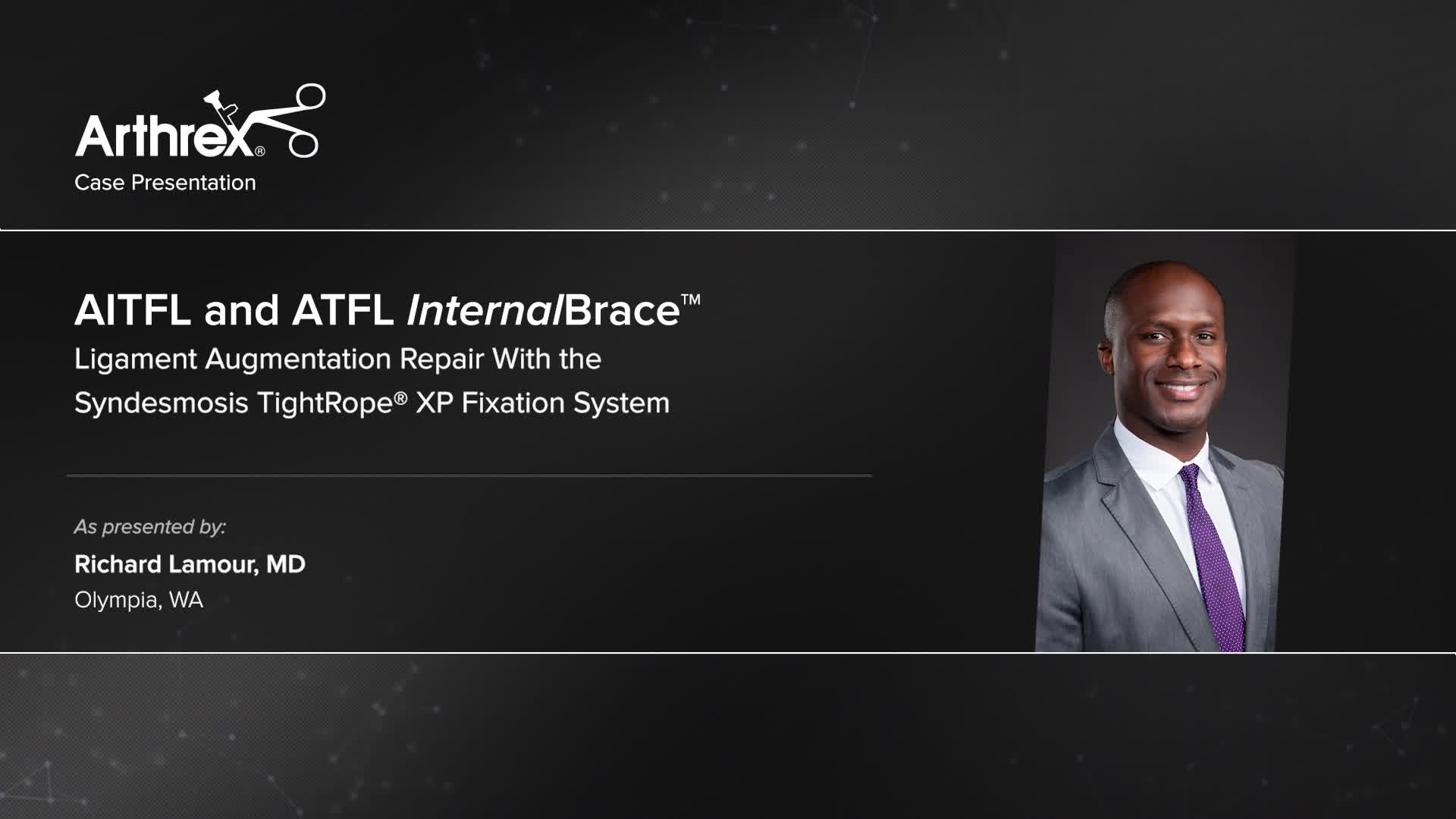 Arthrex - AIFTL And ATFL InternalBrace™ Repair With Syndesmosis ...