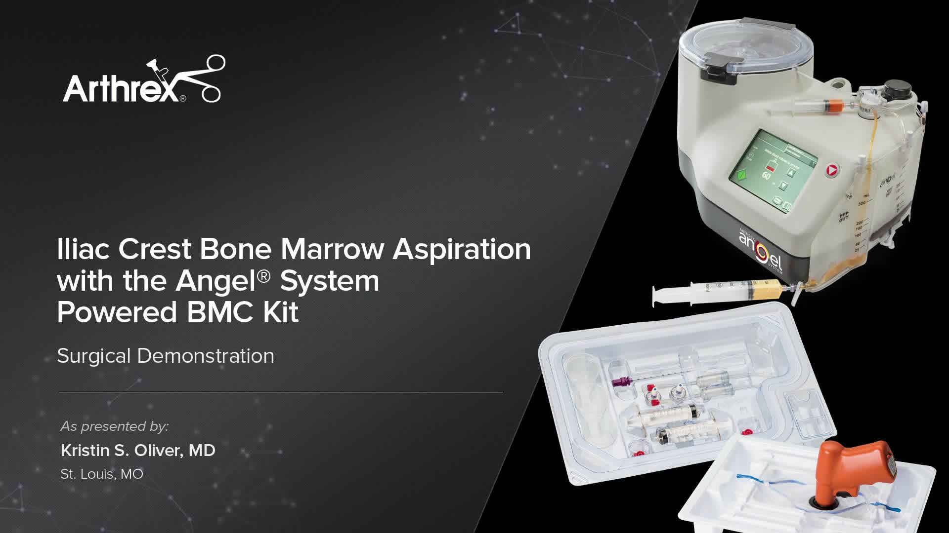 Arthrex - Iliac Crest Bone Marrow Aspiration with the Angel® System Powered  BMC Kit