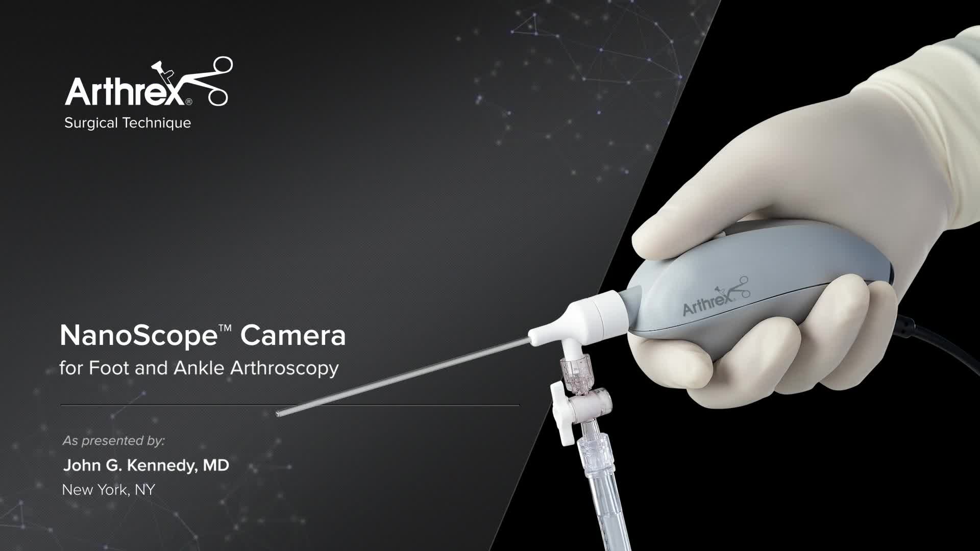 Arthrex - NanoScope™ Camera For Foot And Ankle Arthroscopy