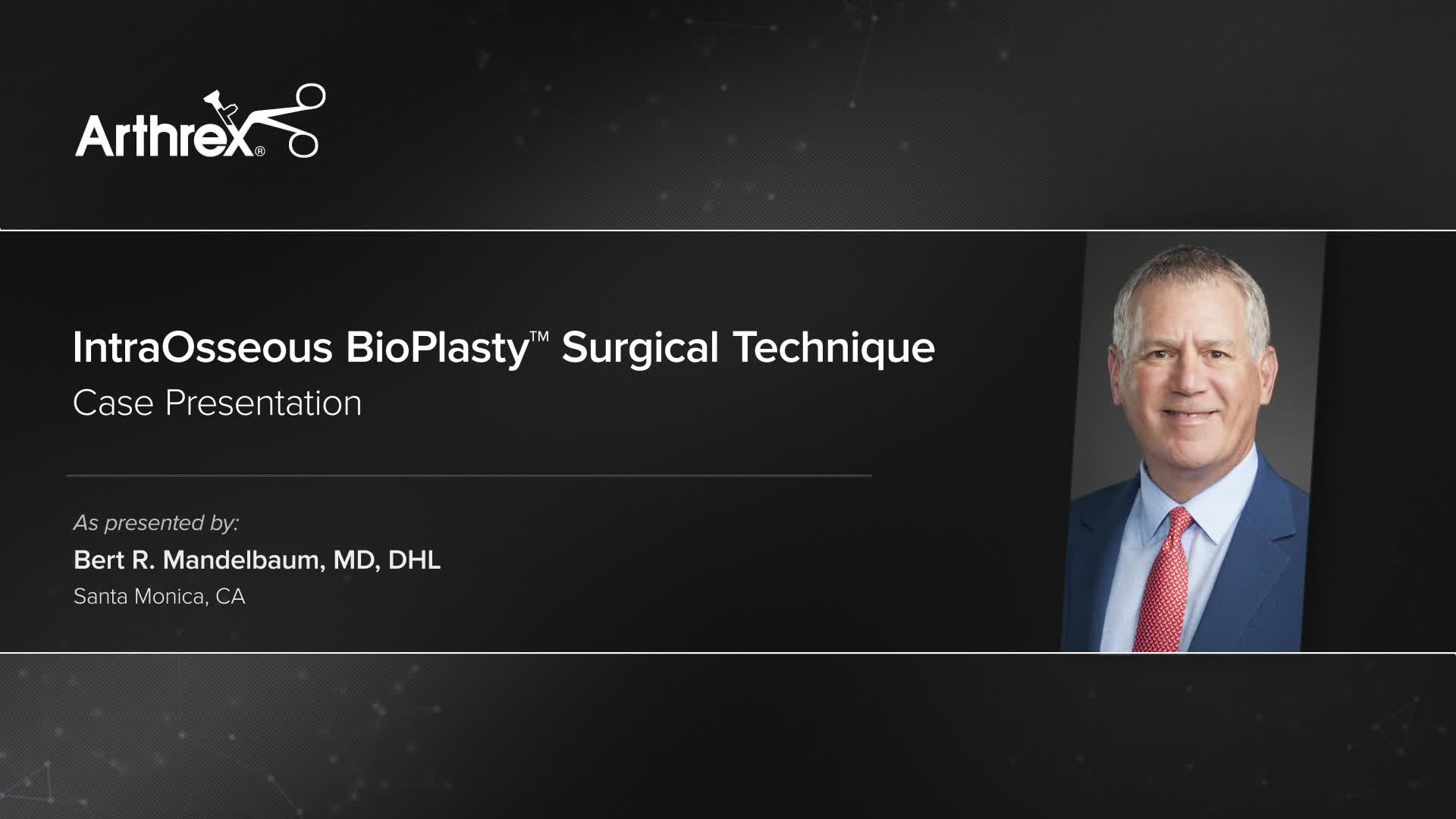 Arthrex - IntraOsseous BioPlasty™ Surgical Technique