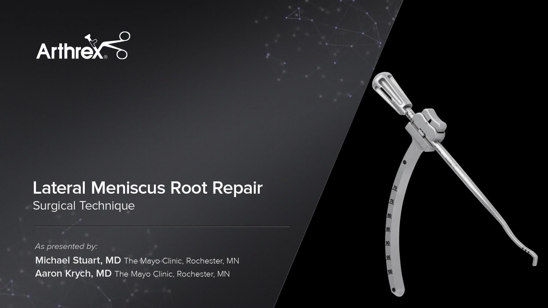 Arthrex Lateral Meniscus Root Repair