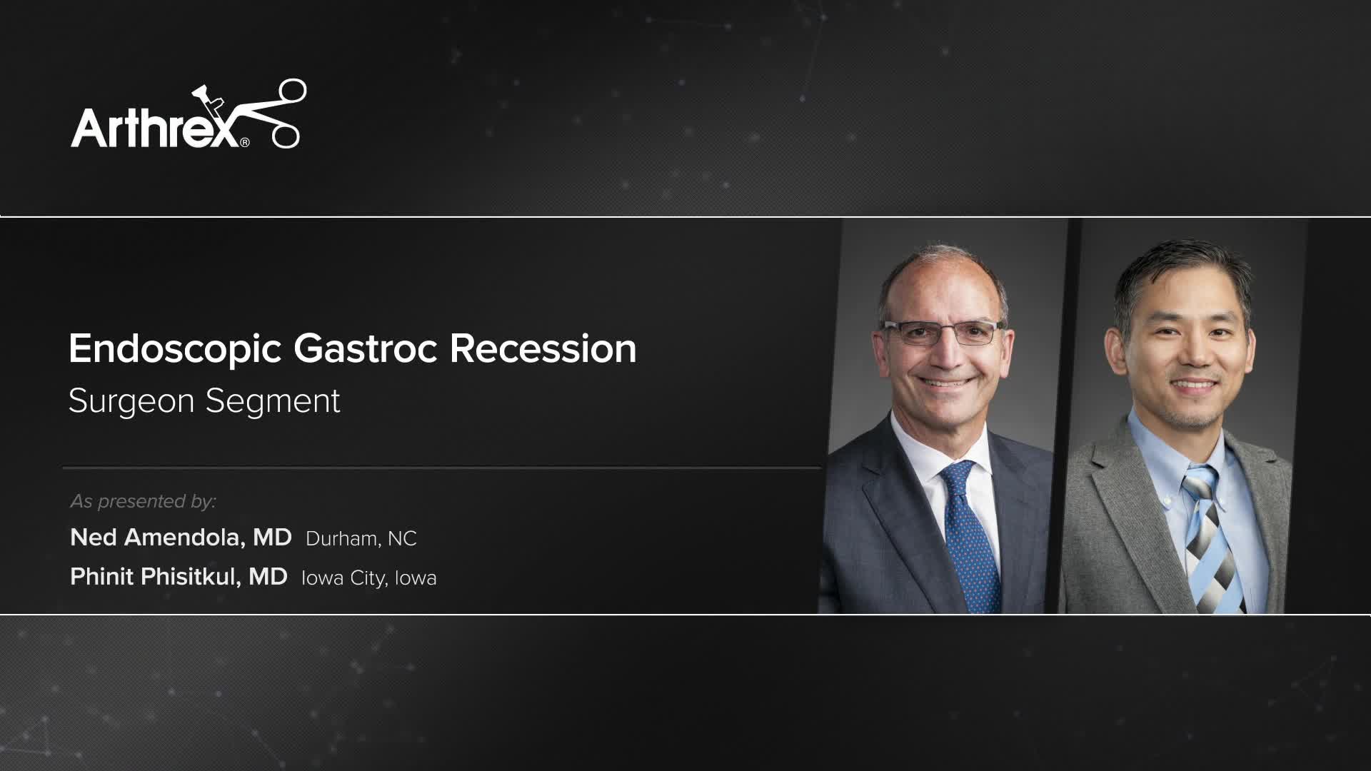 Arthrex Endoscopic Gastroc Recession