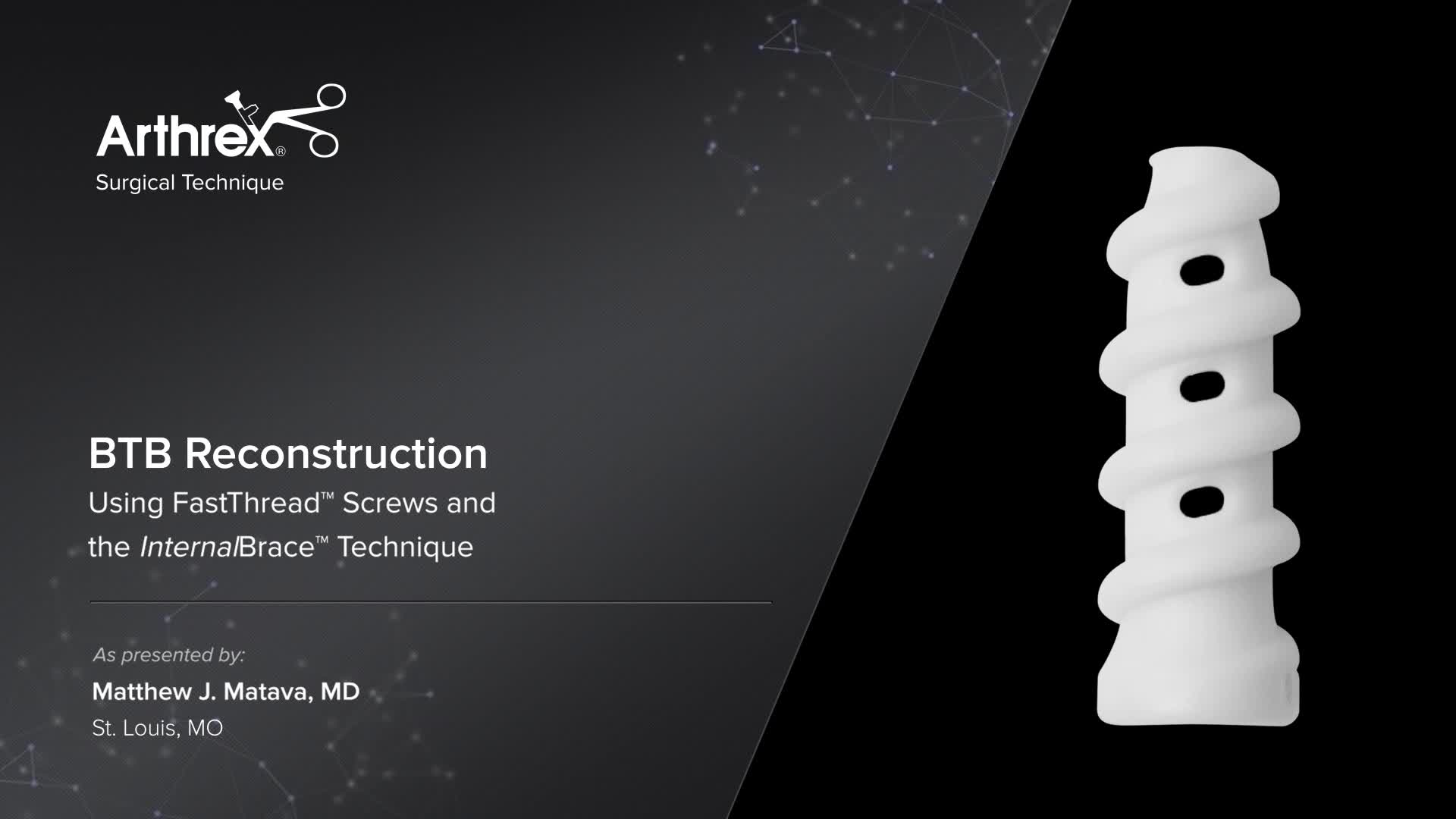 Arthrex Btb Reconstruction Using Fastthread™ Screws And The Internalbrace™ Technique