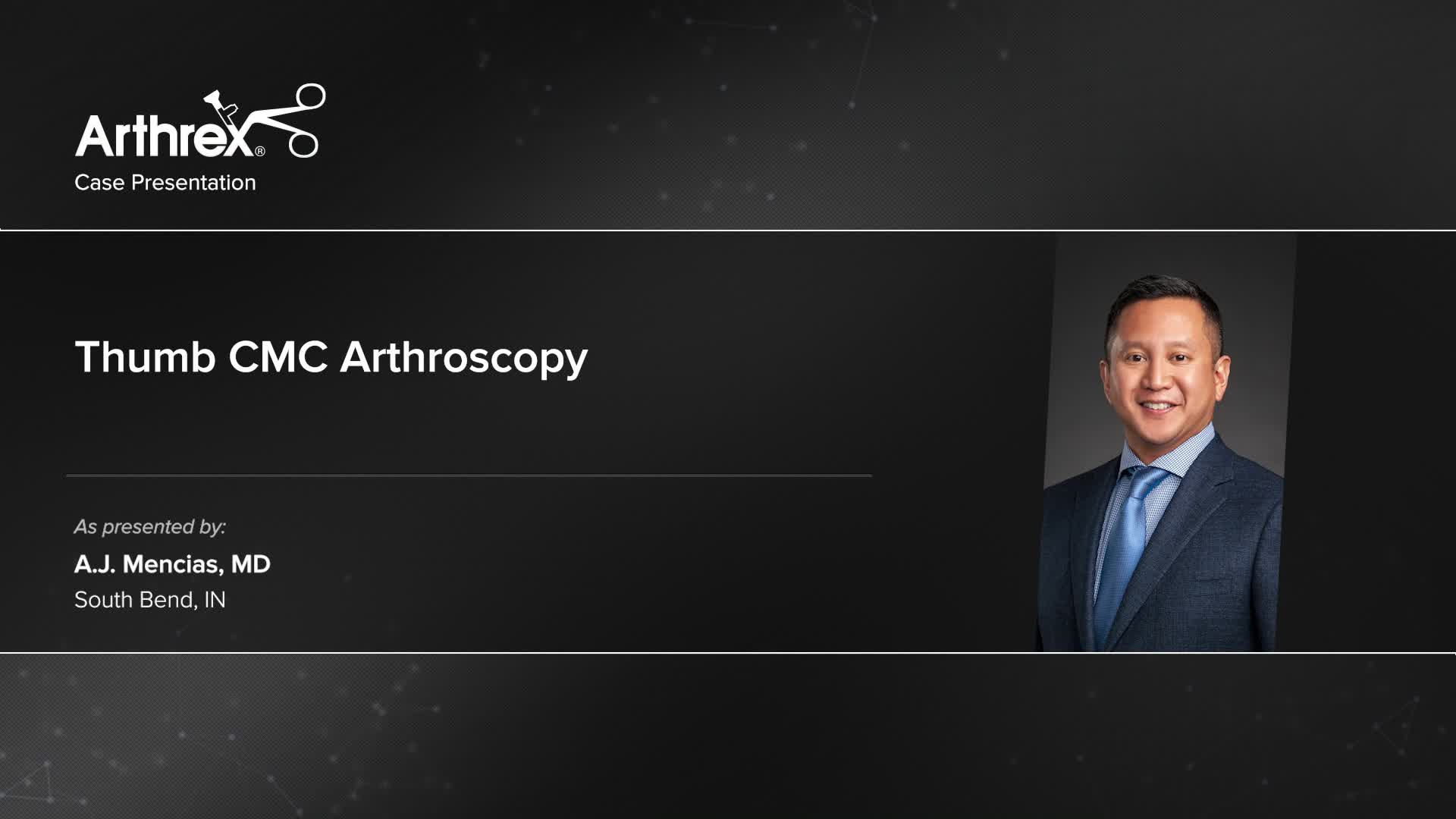 Arthrex Thumb Cmc Arthroscopy Arthrex Thumb Cmc Arthroscopy