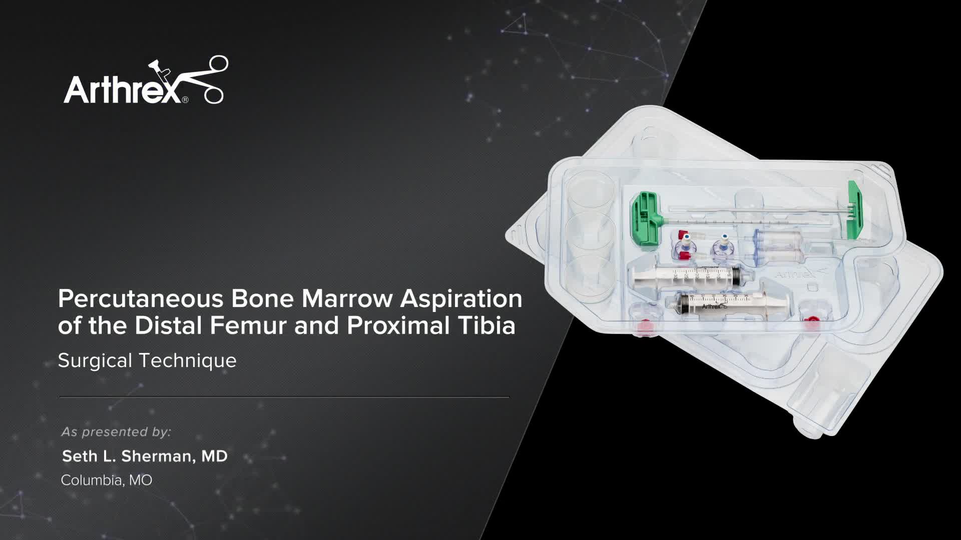 Arthrex Percutaneous Bone Marrow Aspiration Of The Distal Femur And