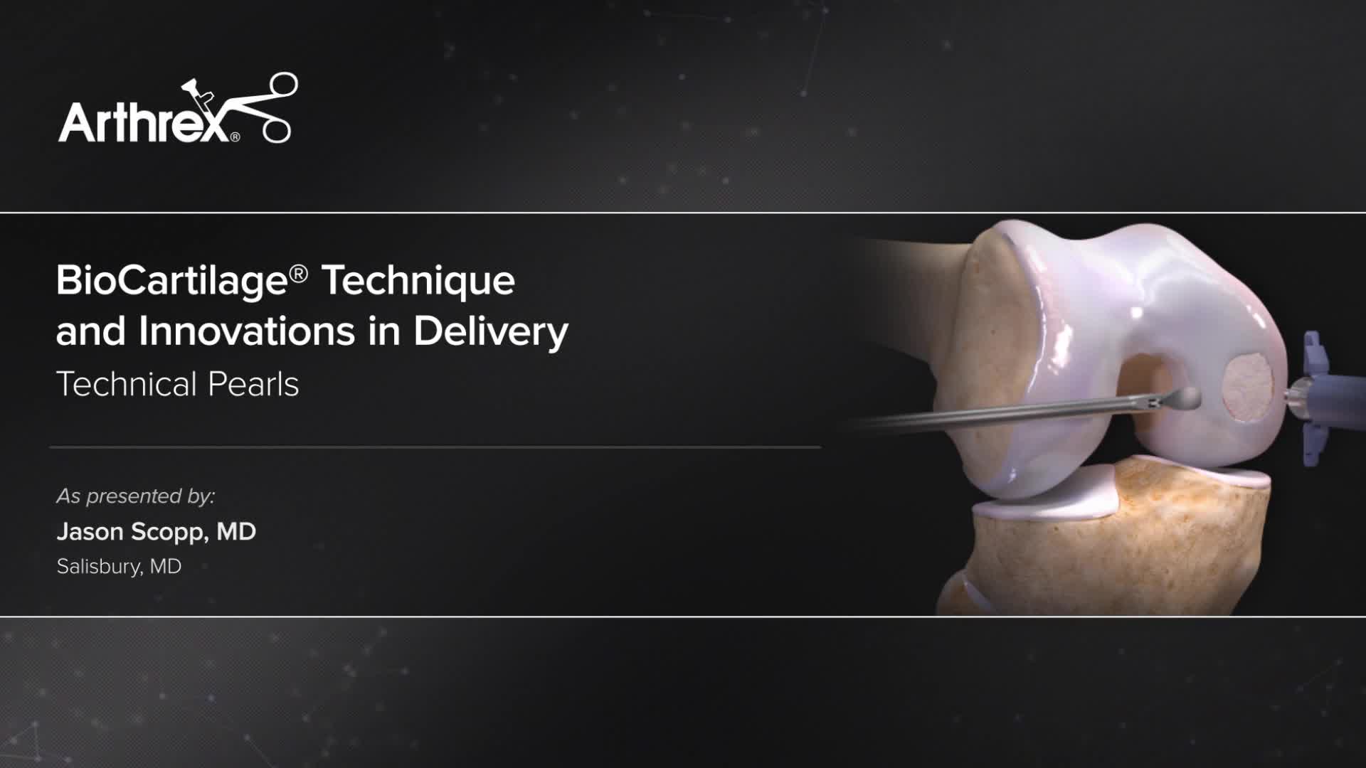 Arthrex - BioCartilage® Technique And Innovations In Delivery