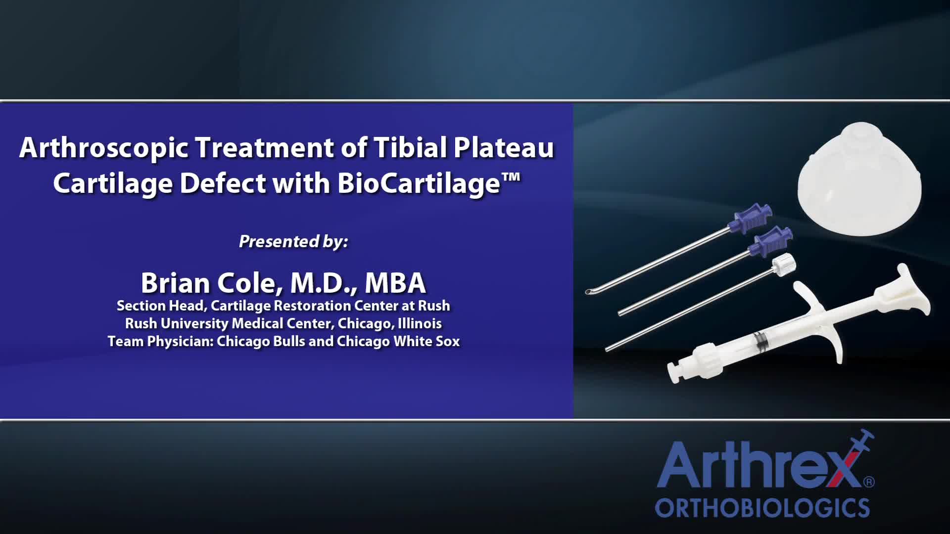 Arthrex Arthroscopic Treatment Of Tibial Plateau Cartilage Defect With Biocartilage