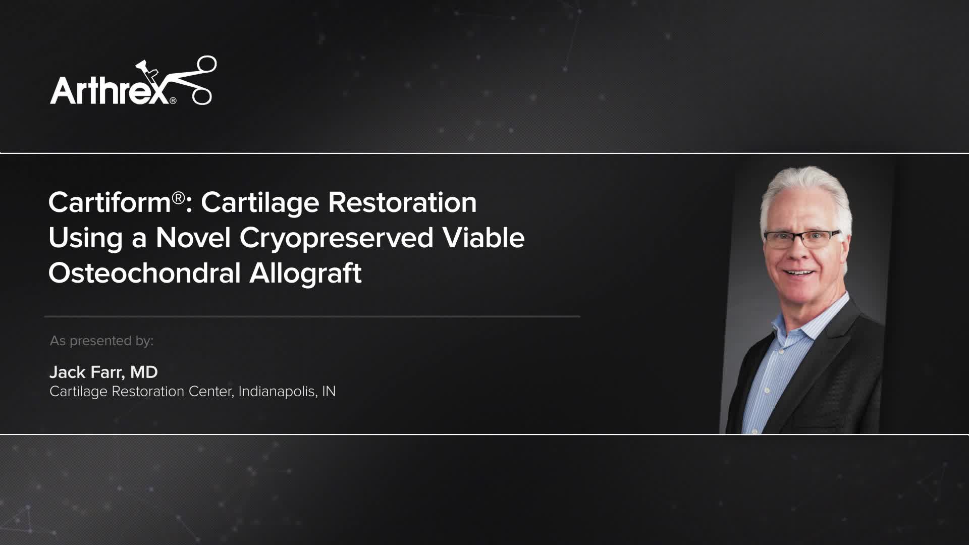 Arthrex - Cartiform®: Cartilage Restoration Using A Novel Cryopreserved ...