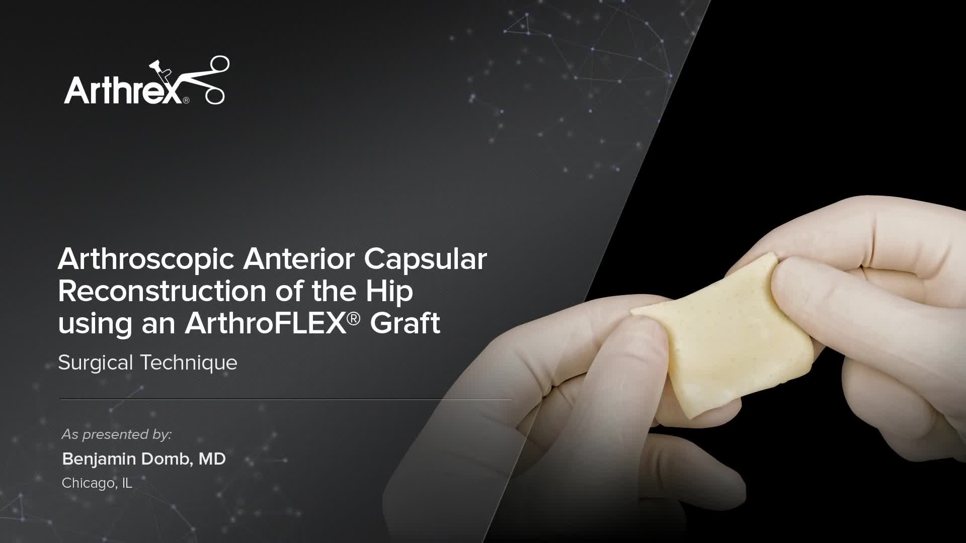 Arthrex - Arthroscopic Anterior Capsular Reconstruction Of The Hip ...