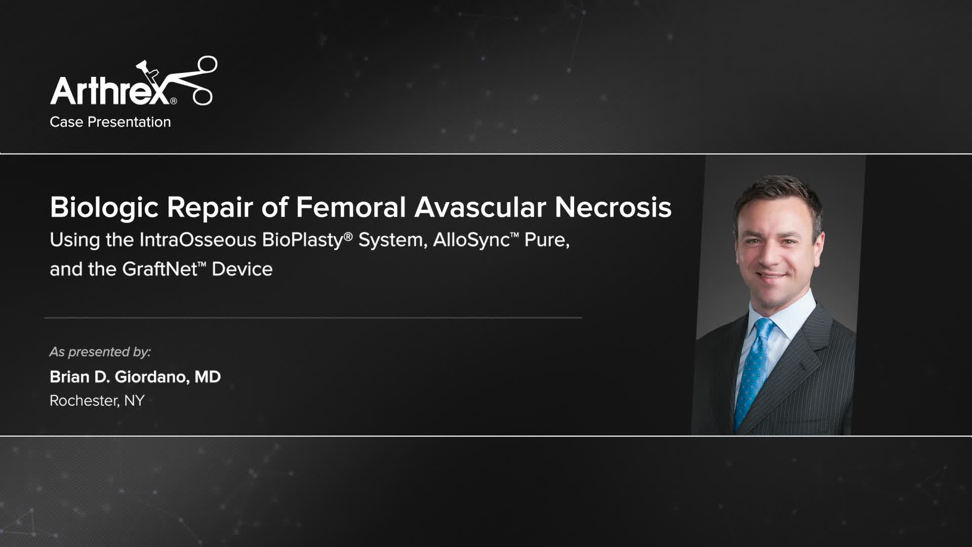 Arthrex - Biologic Repair Of Femoral Avascular Necrosis Using The ...