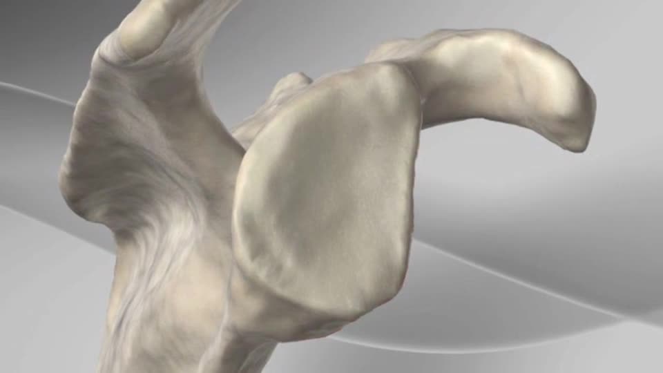 Arthrex - Latarjet/Coracoid Process Transfer for Glenoid Deficiency