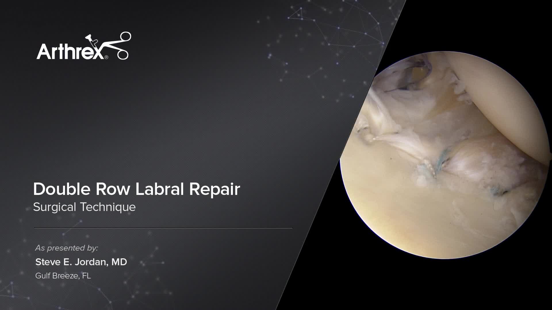 Arthrex - Knot Tying Labral, Instability, ALPSA and HAGL Lesion Repair