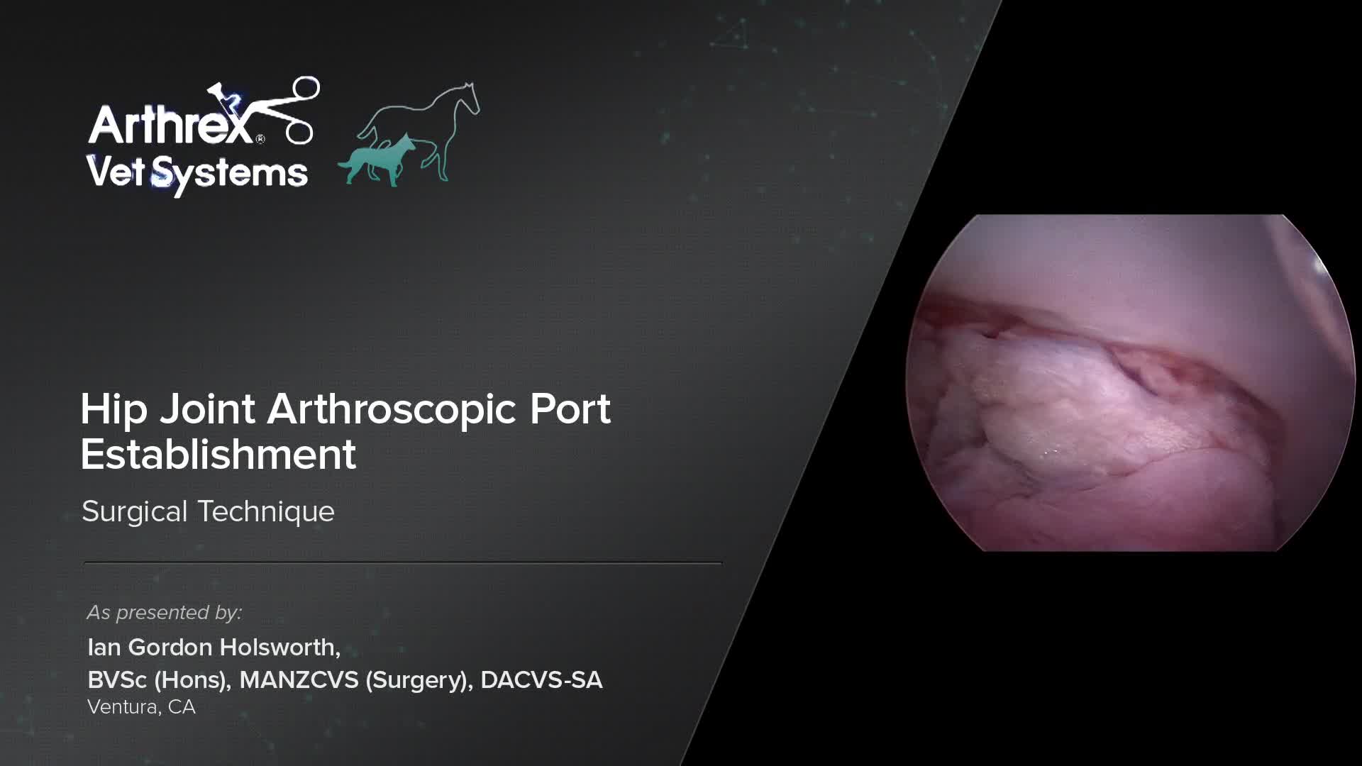 Arthrex - Hip Joint Arthroscopic Port Establishment