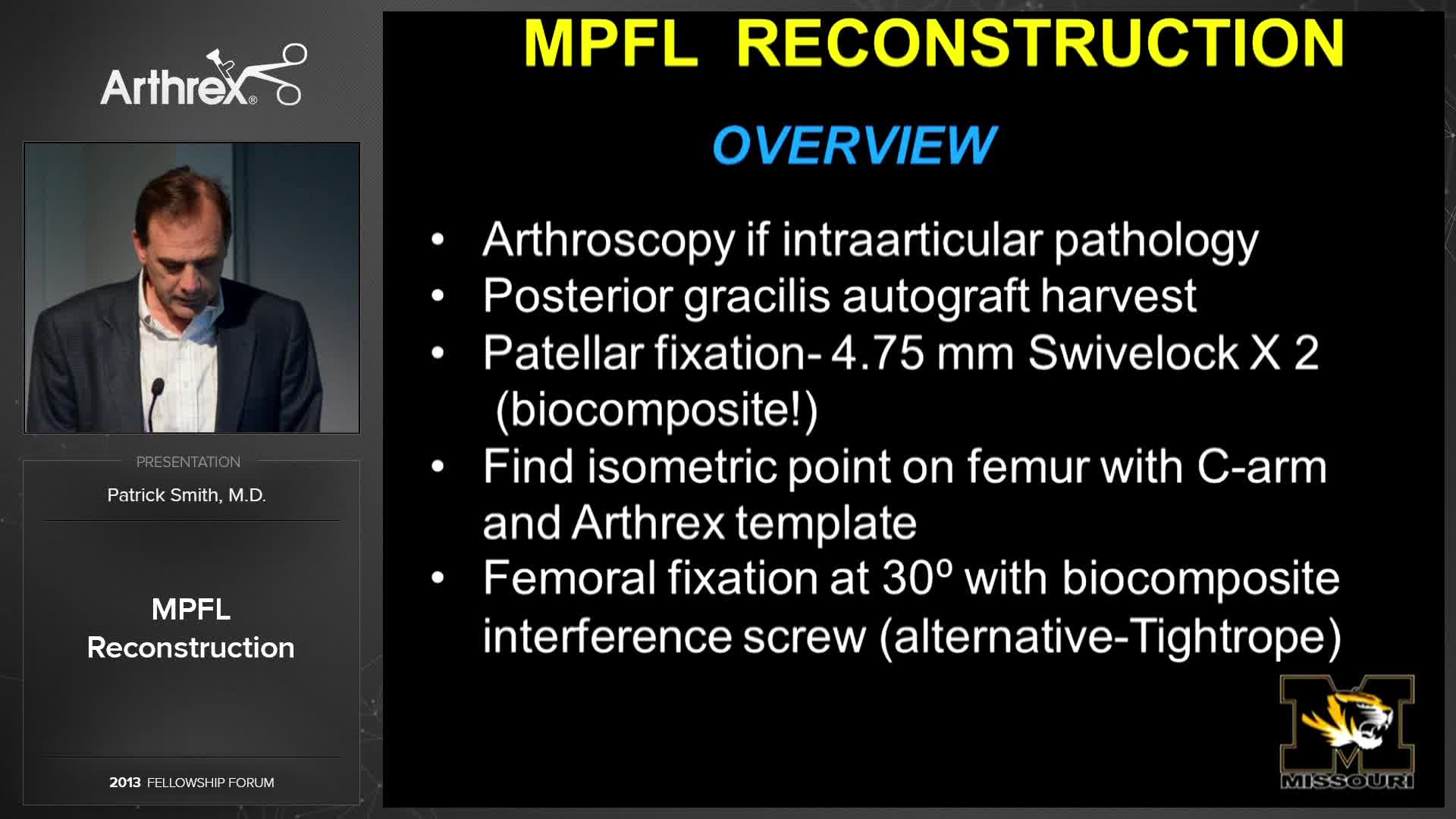 Arthrex - MPFL Reconstruction